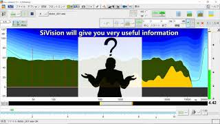 What Is Sivision Livepad?