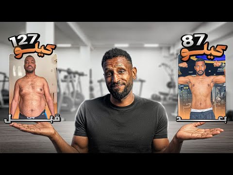 خسر 40 كيلو في 9 شهور بدون ترهلات اسمع قصة احمد