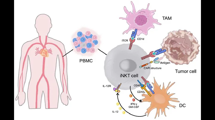 A Landmark Achievement: First Clinical Trial of iPSC-Derived CAR-NK Product Completed