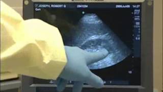 Assessment of Ab and Thoracic Trauma