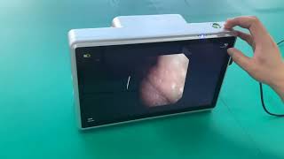 13 3 image processor bronchoscope