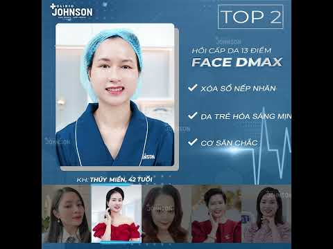 TOP 5 CA