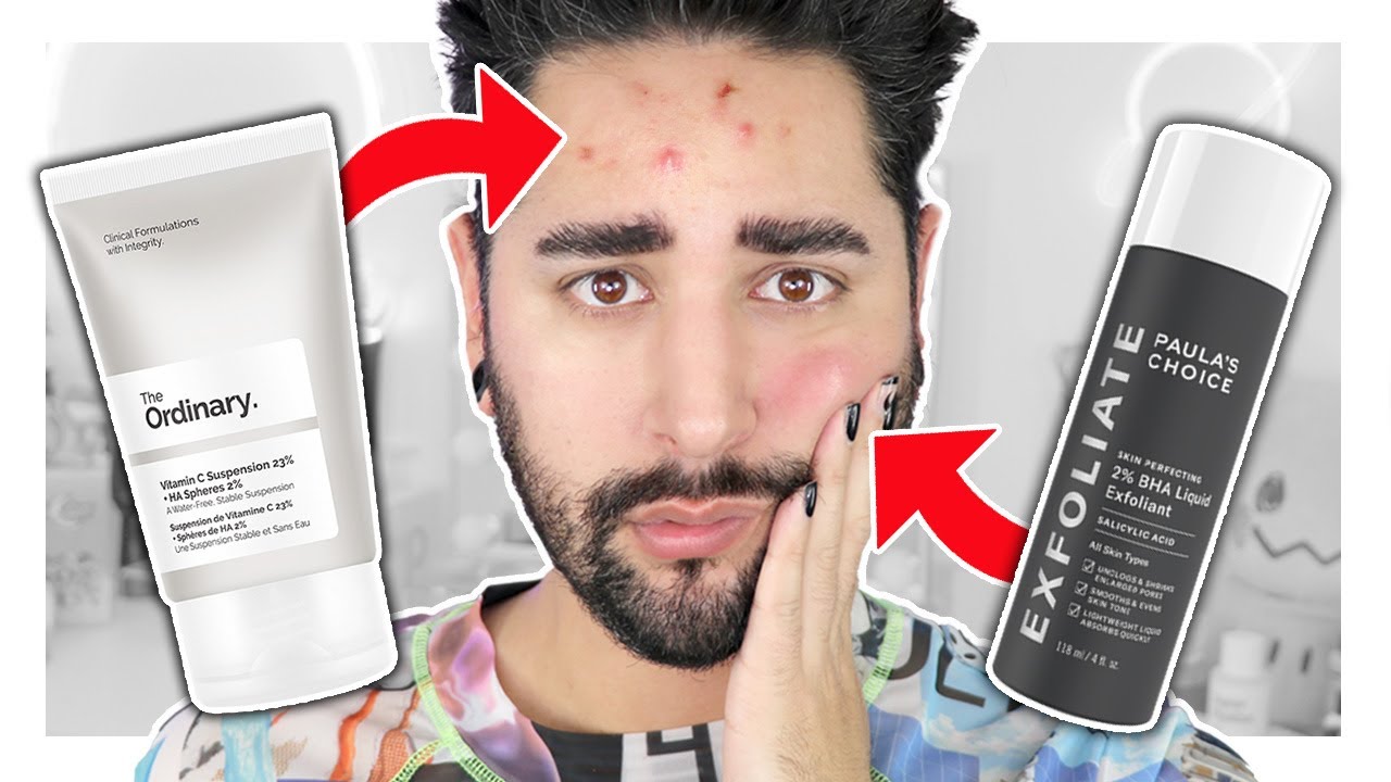 4 Skincare Routine Mistakes We All Make ! Purging, Irritation, Layering