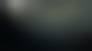 Spiral fracture femur, Closed Ender