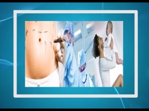 Mommy Makeover - Health Programme | Watch on 07-12-2019 at 1.30pm | DD Chandana | Promo Mommy Makeover - Health Programme | Watch on 07-12-2019 at 1.30pm | DD Chandana | Promo