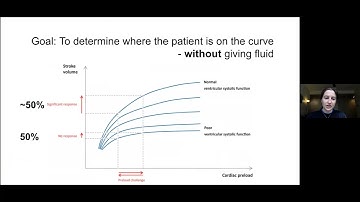 AHD 3 25 21 Predicting Fluid Responsiveness L Onofrey