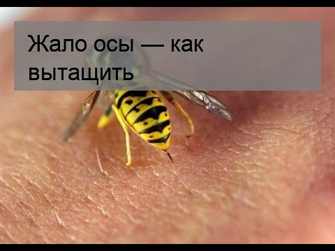 Жало осы — как вытащить