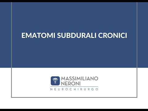 Ematoma Sottodurale Cronico🧠