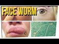 WS - Woman Finds Worm In Her Face ft. DavidSoComedy & Noah Fleder