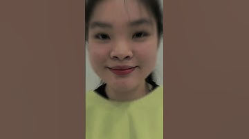 Gặp lại bé gái 17 tuổi sau 1 tháng nâng mũi bên Thành #nguyentrongthanh #nangmui #shorts