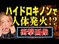 【衝撃画像】ハイドロキノンの使い方を間違えて一生後悔した話