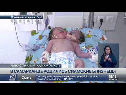 Двухголовые сиамские близнецы родились в Самарканде