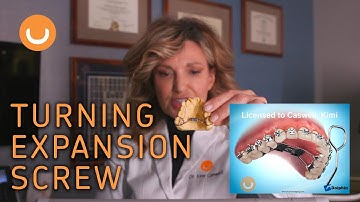 Turning Expansion Screw