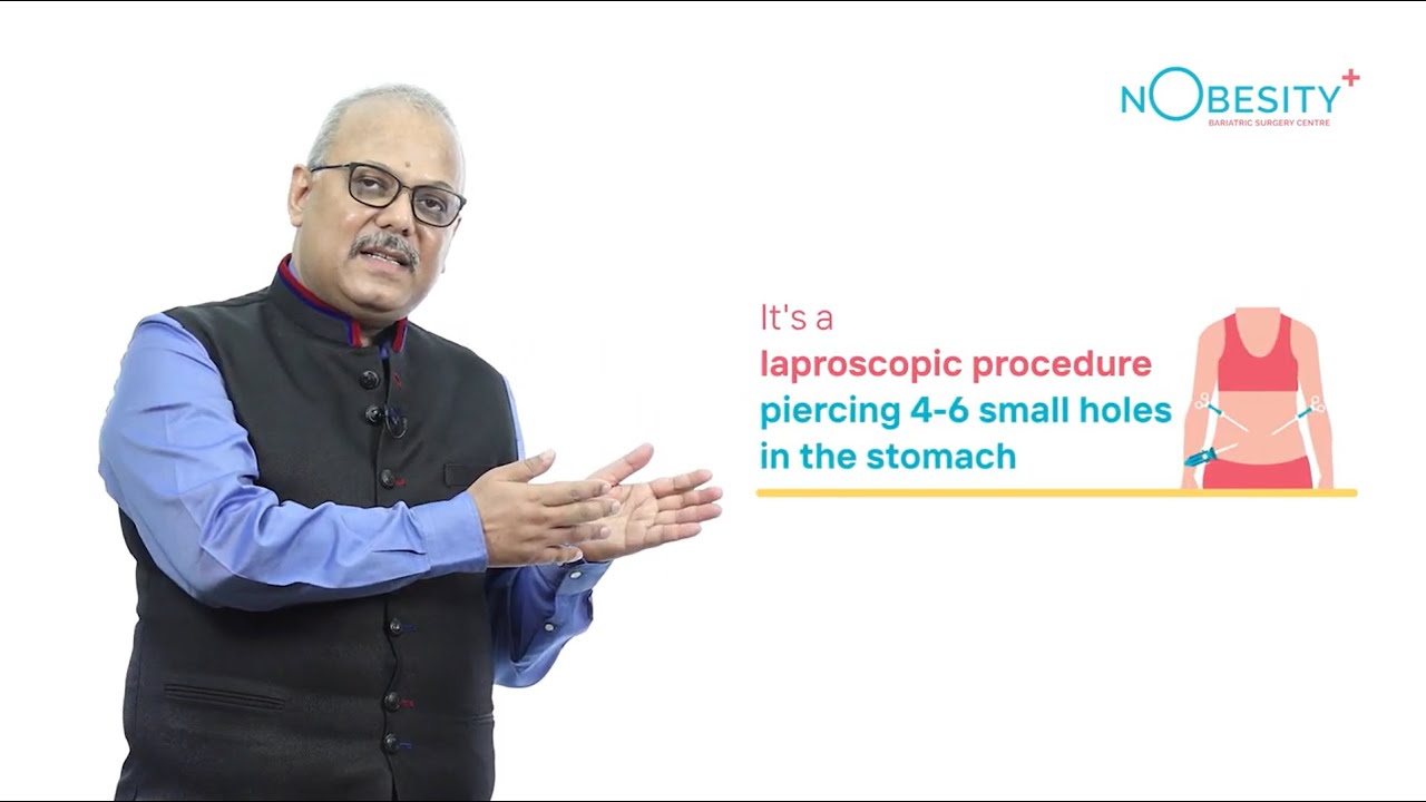 What is Bariatric Surgery & Its Procedure? Bariatric Surgery in India | NObesity