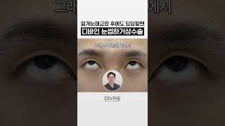 절개 눈매교정 후에도 답답한 눈엔, 눈썹하거상술 ✅