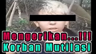 Korban Mutilasi Hidup-hidup Dibrazil | Begini Penjelasannya Korban Mutilasi Hidup-hidup Dibrazil | Begini Penjelasannya