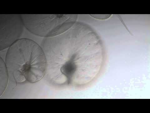 Noctiluca scintillans