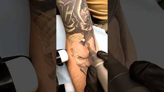 Download Lagu Where Does Tattoo Ink Go After Laser? MP3 Download Lagu Where Does Tattoo Ink Go After Laser? MP3