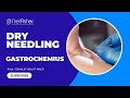 How to Perform Dry Needling on the Gastrocnemius Muscle