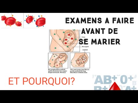 Vidéo: COMMENT SE METTRE EN MARIAGE PAR ÉTABLISSEMENT ? Et Est-ce Que ça Vaut Le Coup ?