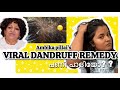 താരൻ മാറാൻ ഉള്ള ഒരു Viral Remedy നോക്കിയാലോ? Ambika pillai remedy | Dandruff #dandruff