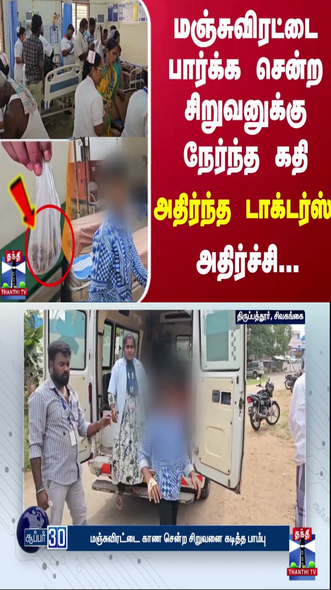 மஞ்சுவிரட்டை பார்க்க சென்ற சிறுவனுக்கு நேர்ந்த கதி.. அதிர்ந்த டாக்டர்ஸ் - அதிர்ச்சி