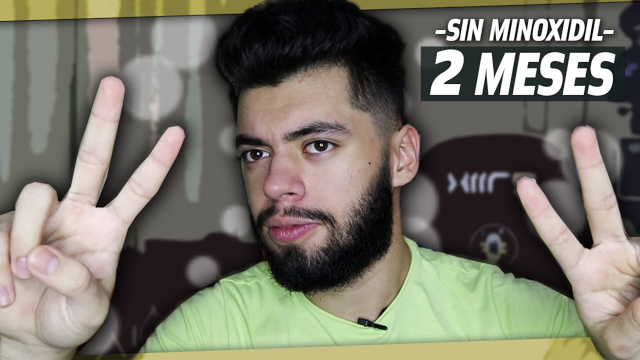 2 MESES SIN MINOXIDIL ¿QUE HA PASADO?