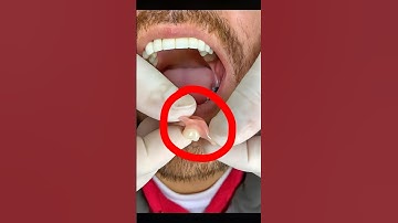 2025 The Future of Dental Prosthesis: A Flexible & Easier Chew!