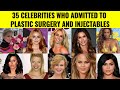 35 Celebrities Who Admitted To Plastic Surgery And Injectables (Part 1)