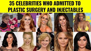 35 Celebrities Who Admitted To Plastic Surgery And Injectables (Part 1)