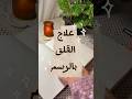 العلاج بالرسم رسم للتخلص من التوتر رسم خطوط     رسم  