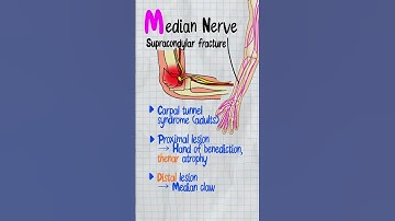 USMLE Step 1 Mnemonic for Brachial Plexus Nerve Injuries | ARM-U Explained in 60s