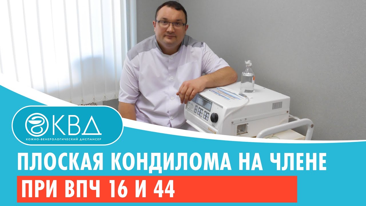 😕 Плоская кондилома на члене при ВПЧ 16 и 44. Клинический случай №660