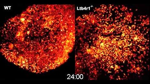 Spatiotemporal Basis of Innate and Adaptive Immunity in Secondary Lymphoid Tissue: Video 6