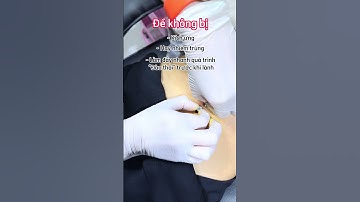 Xỏ khuyên rốn để lại sẹo và sau đây sẽ là 3 lưu ý dành riêng cho bạn