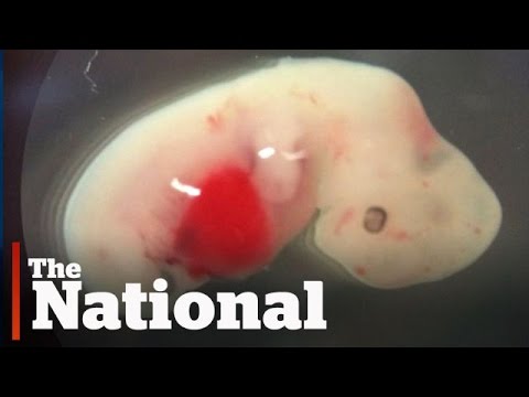 Video: The Chimero Are Here. Scientists Have Created A Hybrid Of A Human And A Pig - Alternative View