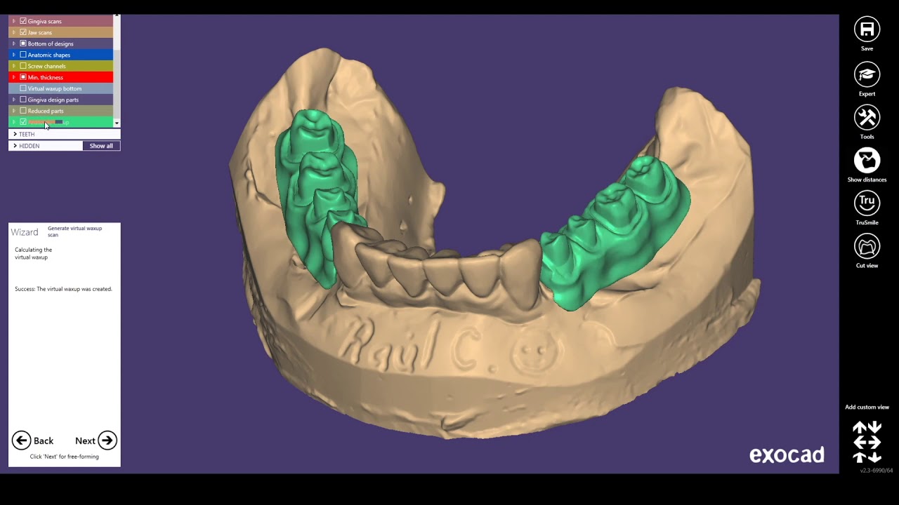 DISEÑO BARRAS TORONTO