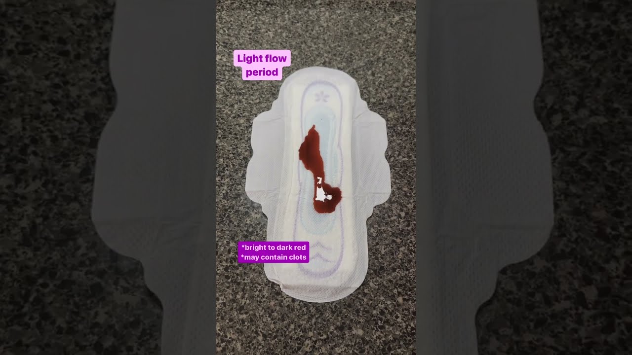 Is Your Period Bleeding Normal It Implantation Or Ovulation Spotting Menstrualcycle