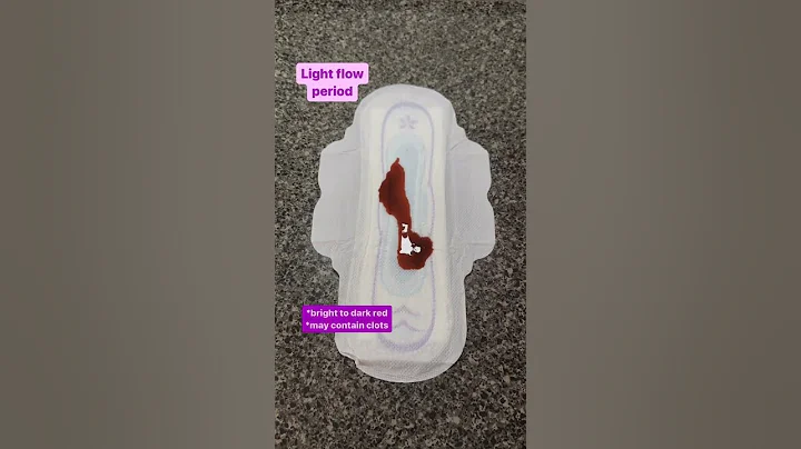 Is your period bleeding normal? Is it implantation bleeding or ovulation spotting?  #menstrualcycle