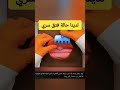 محاكاة عملية إصلاح الفتق السري