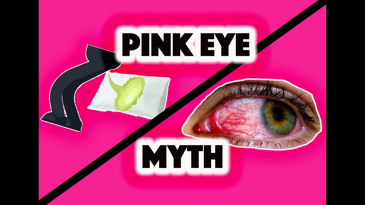 Myth: Farting On Pillow Case Cause Pink Eye