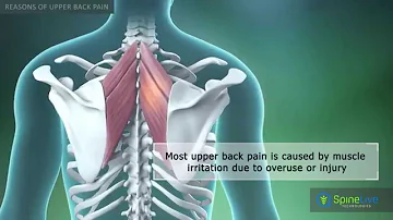 Upper Back Pain Reasons