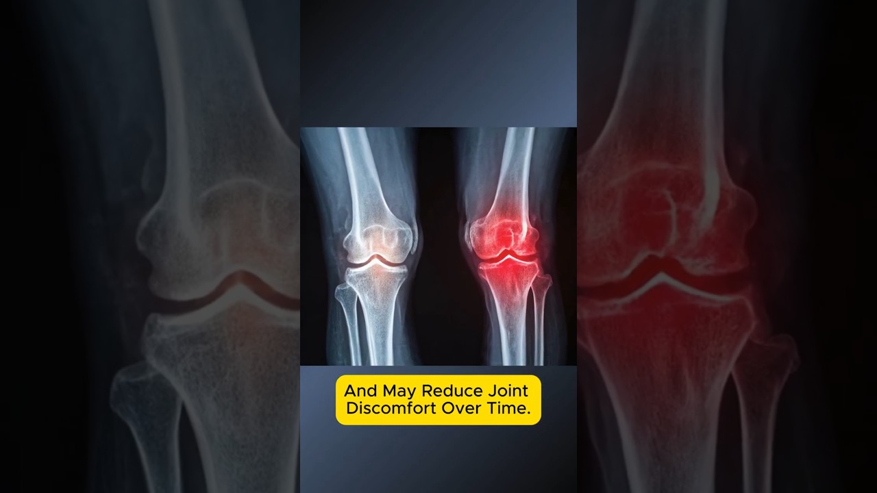 Arthritis Relief Starts With THIS Vitamin!#arthritis #arthritisrelief   #healthtips #wellness