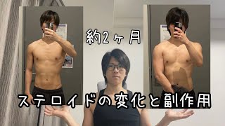 アナボリックステロイド使ってみた体の変化と副作用