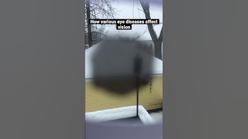 Eye Disease Vision Simulation #eyedisease #vision #simulation #cataracts #glaucoma