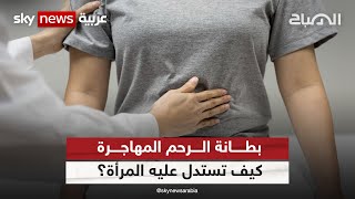 بطانة الرحم المهاجرة.. كيف تستدل عليه المرأة؟ | الصباح