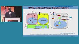 SABCS 2022: Dr. Adentunji Toriola