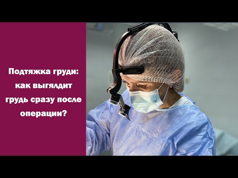 Результат подтяжки груди без имплантов: Как выглядит грудь сразу после операции?