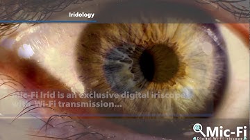 Mic-Fi Irid - The Exclusive Digital Wi-Fi Iriscope
