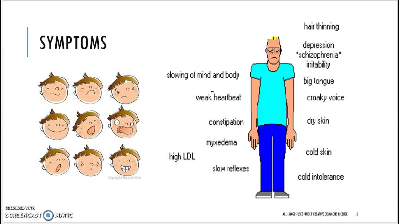 Hashimoto's Thyroiditis The Big Picture YouTube